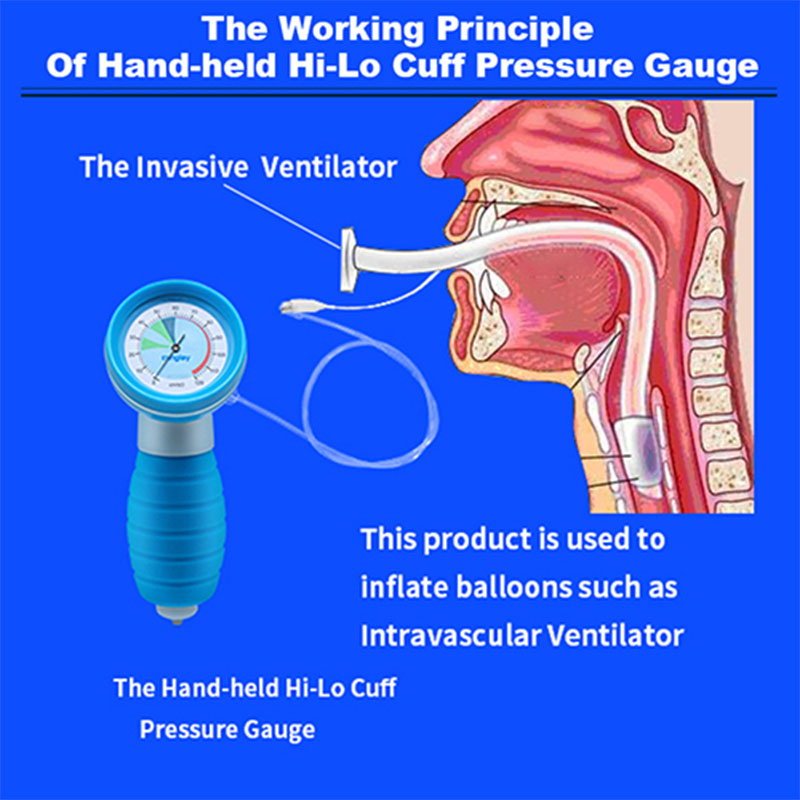 How does the medical device cuff pressure gauge ensure the accuracy of cuff inflation during endotracheal intubation?