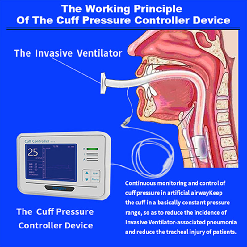 How does a medical device cuff controller ensure optimal cuff pressure for patients with tracheal cuffs during mechanical ventilation?